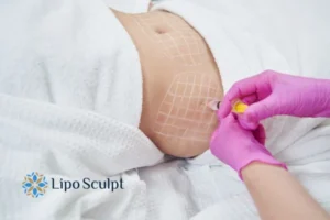 Are The Results From Aqualyx Permanent? 1 Do you want to know how long Aqualyx Runnymede results last?